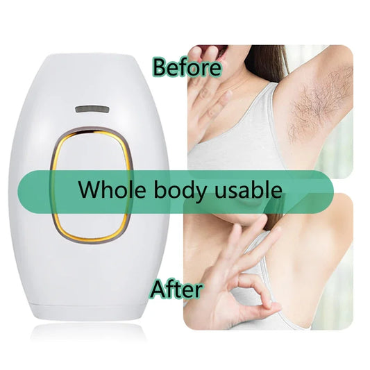 IPL Laser Hair Removal Handset System for Women & Men with Razor & Safety Glasses